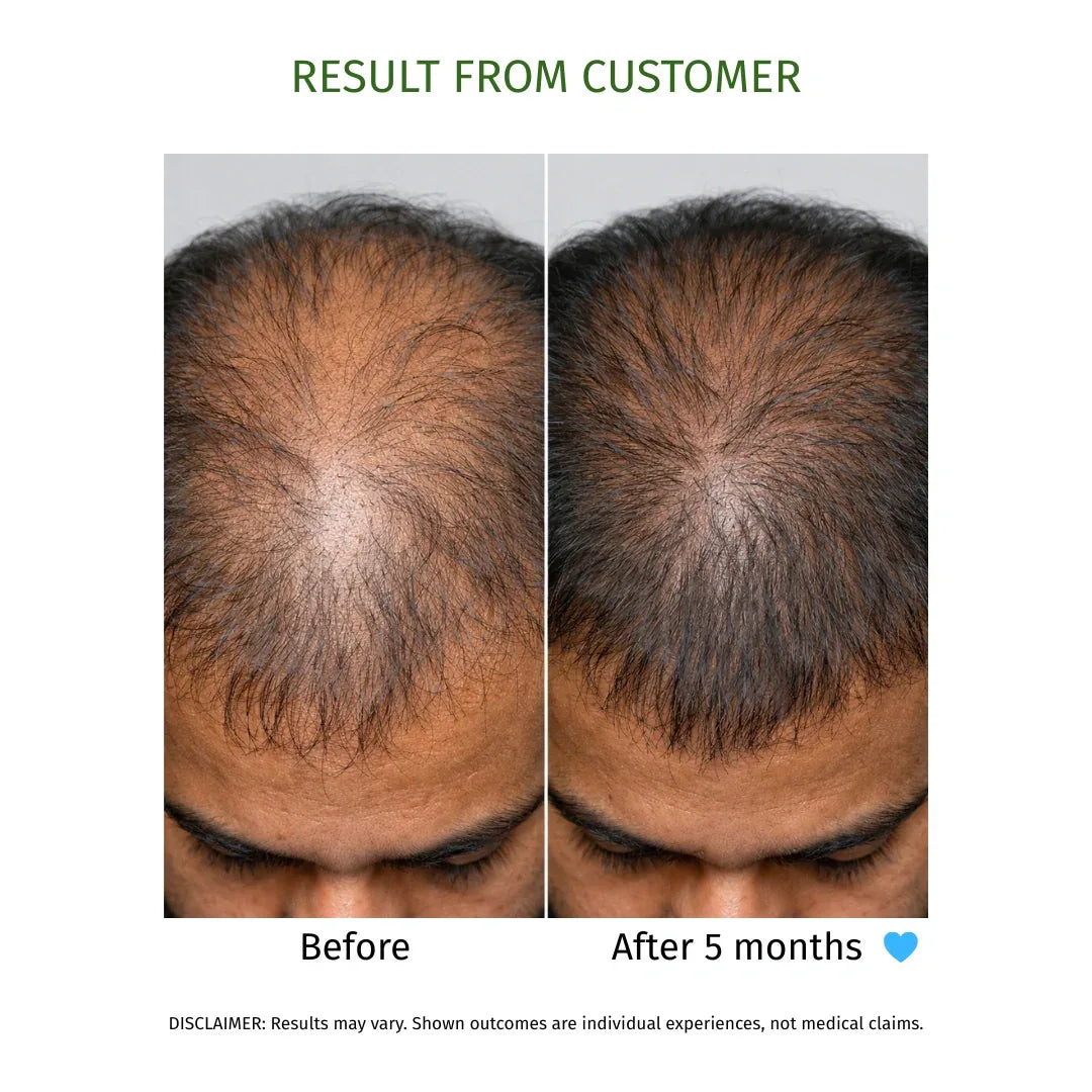 KESHKUMARI hair fall control oil- 100ml - La Botanique 