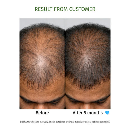 KESHKUMARI hair fall control oil- 100ml - La Botanique 