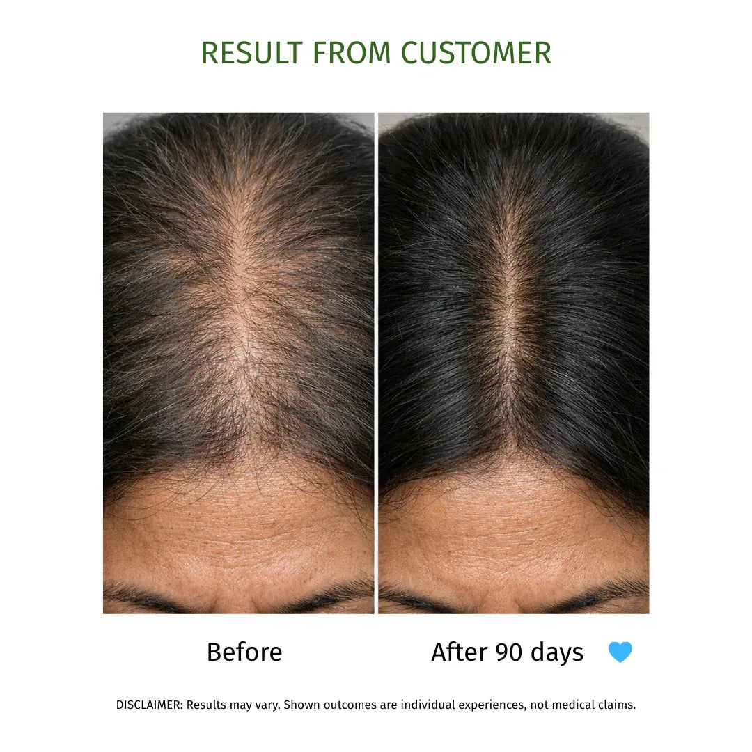 KESHKUMARI hair fall control oil- 100ml - La Botanique 