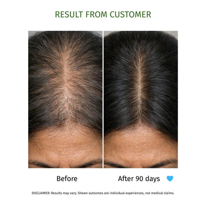 KESHKUMARI hair fall control oil- 100ml - La Botanique 